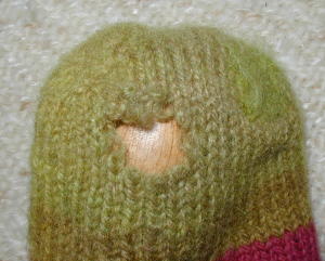 The hole before darning